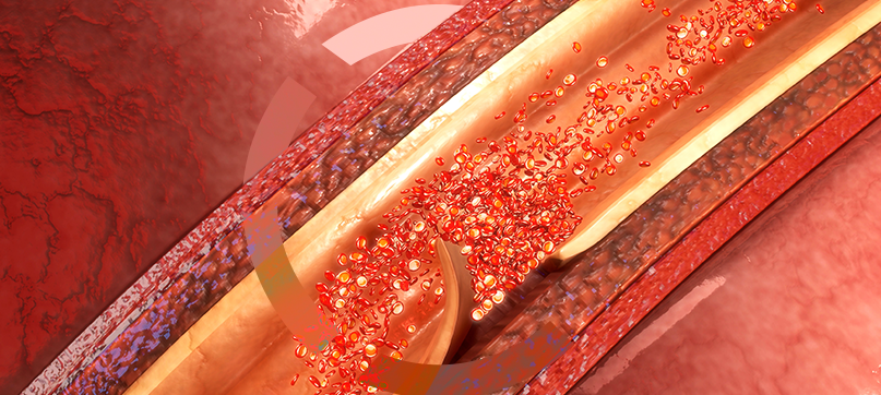 Imagem interna tratamento de vasinhos da face Clariana Casali